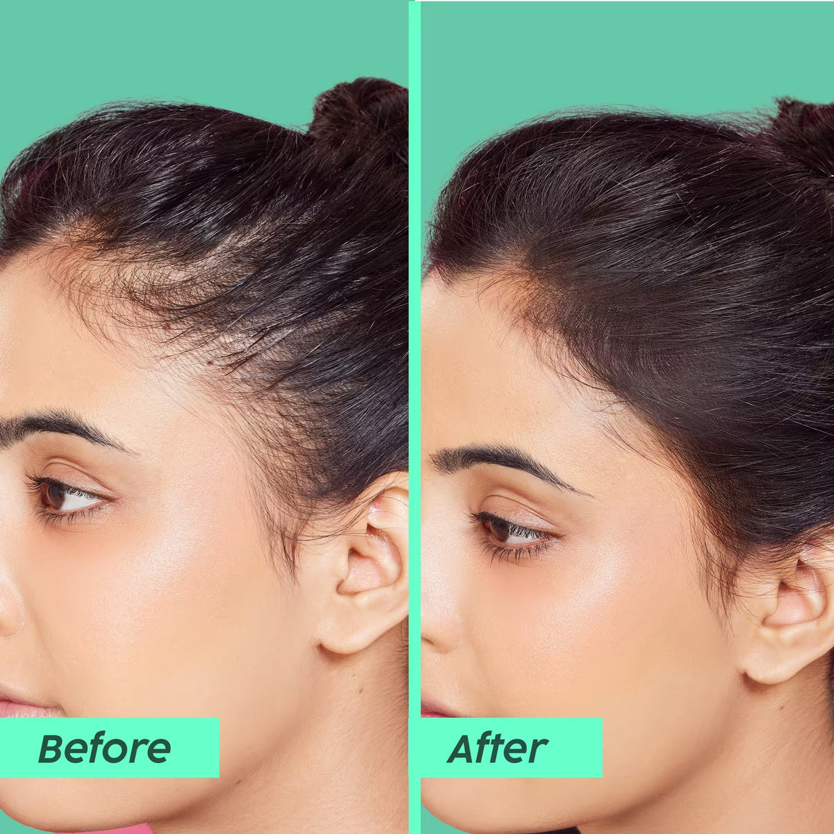 Rosemary Anti-Hairfall Advanced Kit with Shampoo, Conditioner & Serum