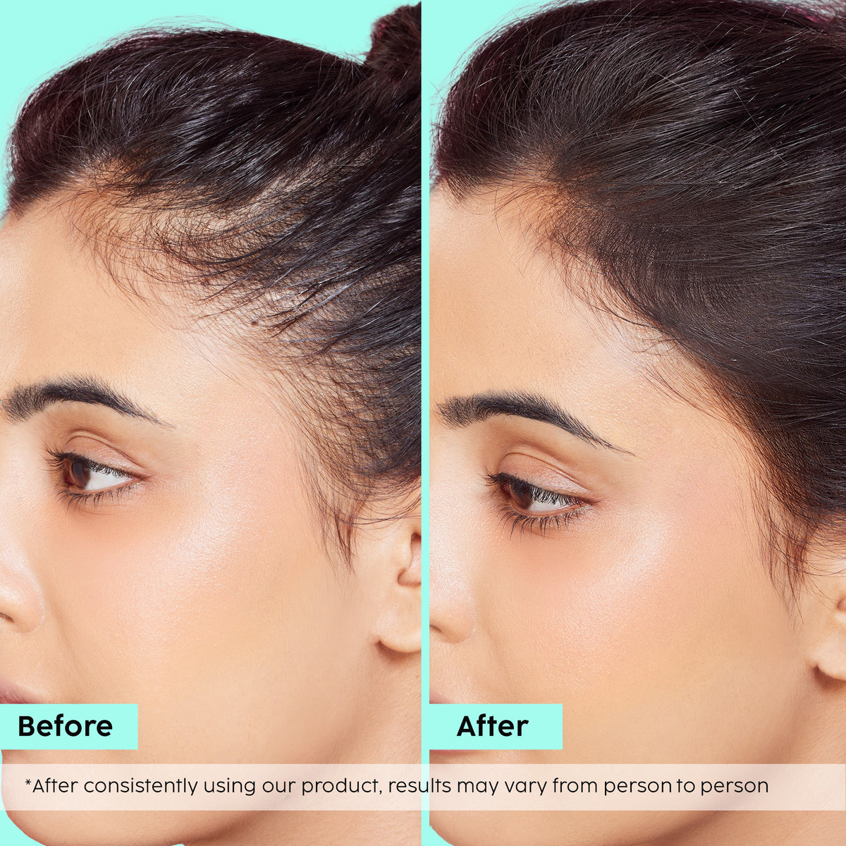 Rosemary Hair Growth Advanced Hair Spray – Fuller, Thicker Hair