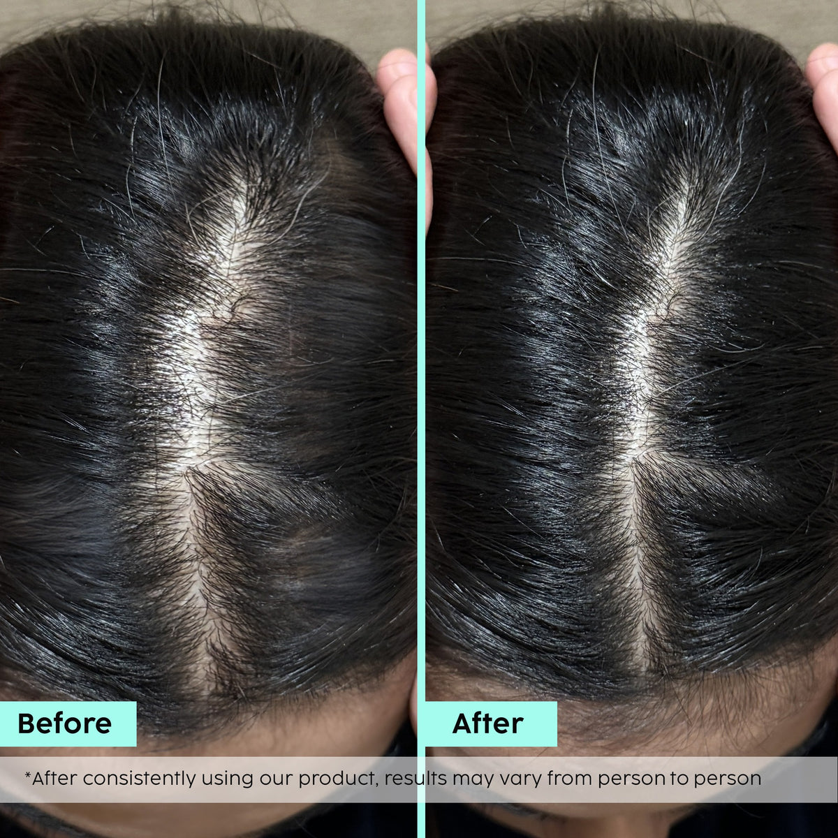 Rosemary Hair Growth Advanced Hair Spray – Fuller, Thicker Hair
