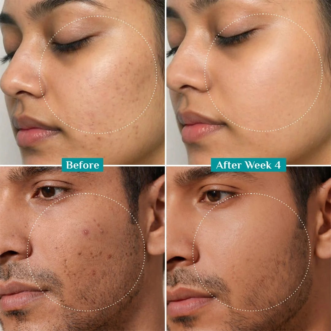 Pilgrim 10% Niacinamide Face Serum