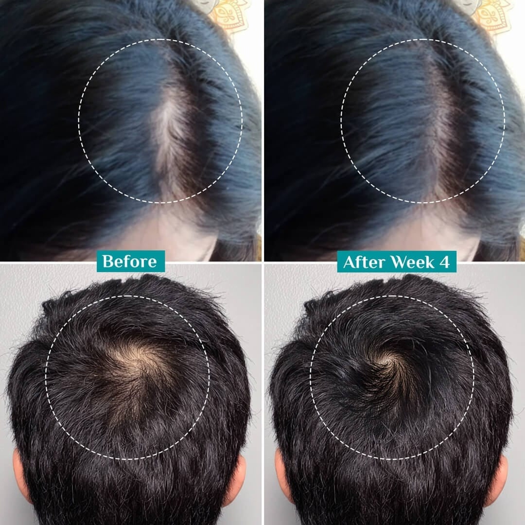 Pilgrim Advanced Hair Growth Serum