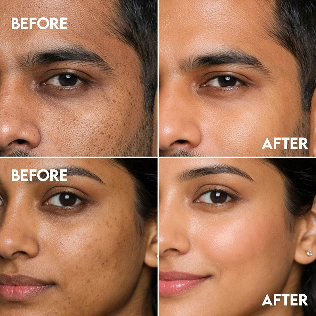 De-Tan Face Wash for Tan Removal | Gently Cleanses - [120ml]